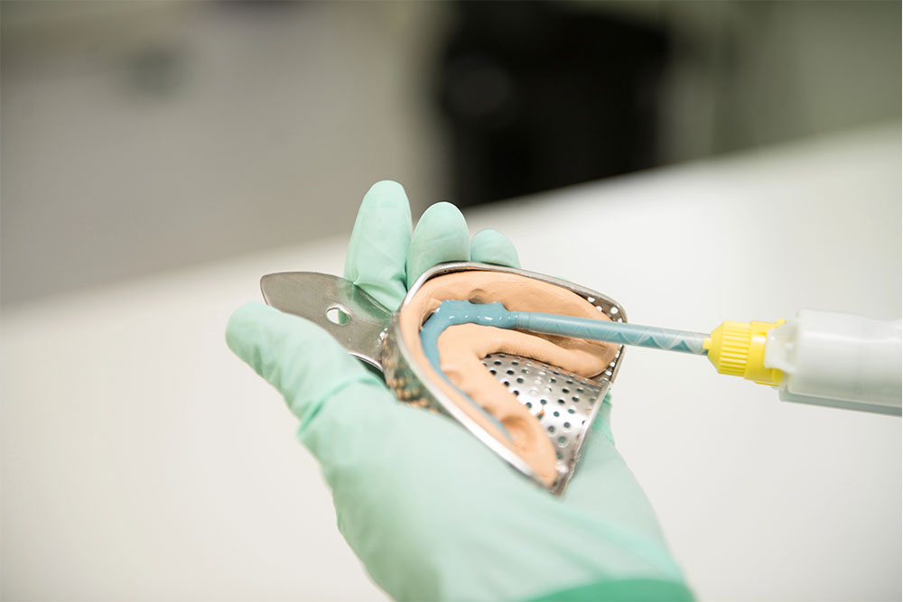 common-dental-impression-errors-every-dentist-should-watch-for