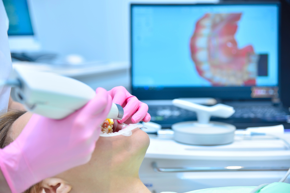 Medit i700 Vs. 3Shape Trios: Which Scanner Fits Your Dental Practice?
